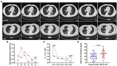 Effect of vitamin D status on adult COVID-19 pneumonia induced by Delta variant: A longitudinal, real-world cohort study